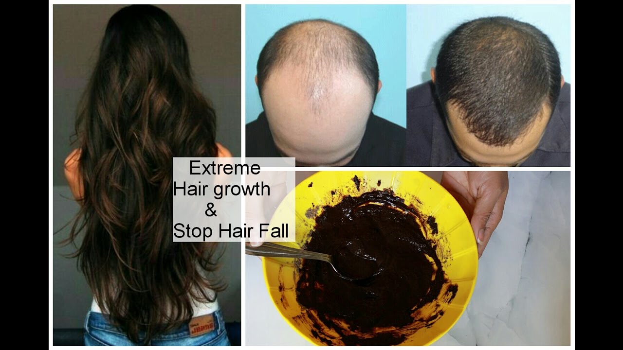 Anitha Kuppusamy - 📣 Resolve Hair Issues with Bhringraj Powder Hair Fall  Issues? Tired of trying chemical supplements ? Switch to an inevitable  ayurvedic solution - Bhringraj Powder. Widely known as Karisalankanni