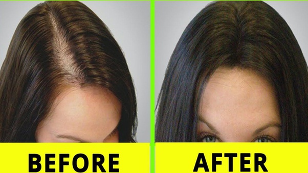 Ayurvedic Hair Oil  Strengthen  Nourish Hair  Neelibringhadi Oil